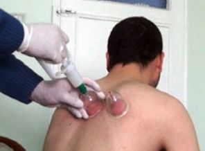 Birçok hastalığa deva: Hacamat Birçok hastalığa deva: Hacamat