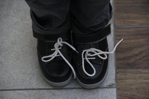 24 parmaklı çocuğa devletten özel ayakkabı1