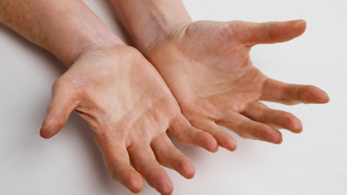 Ноющая боль в пальцах рук. Распространённые руки. Из ваших кривых рук. Handness.