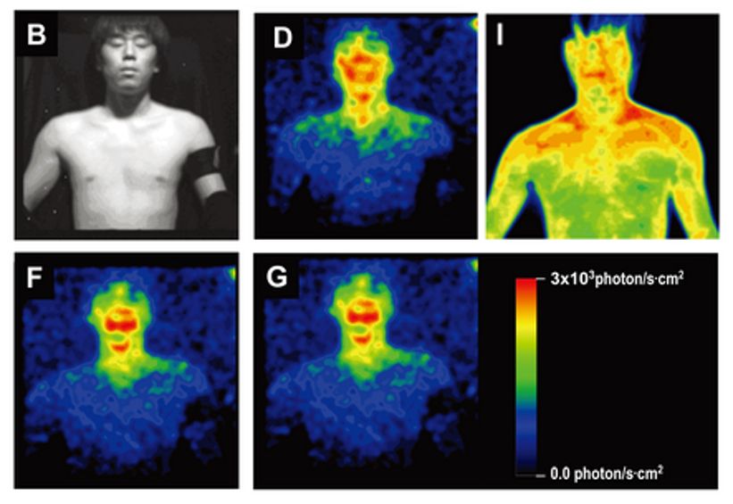 lrg-1179-glowing-humans-auras-thermographic-image-ultraweak-photon-emission