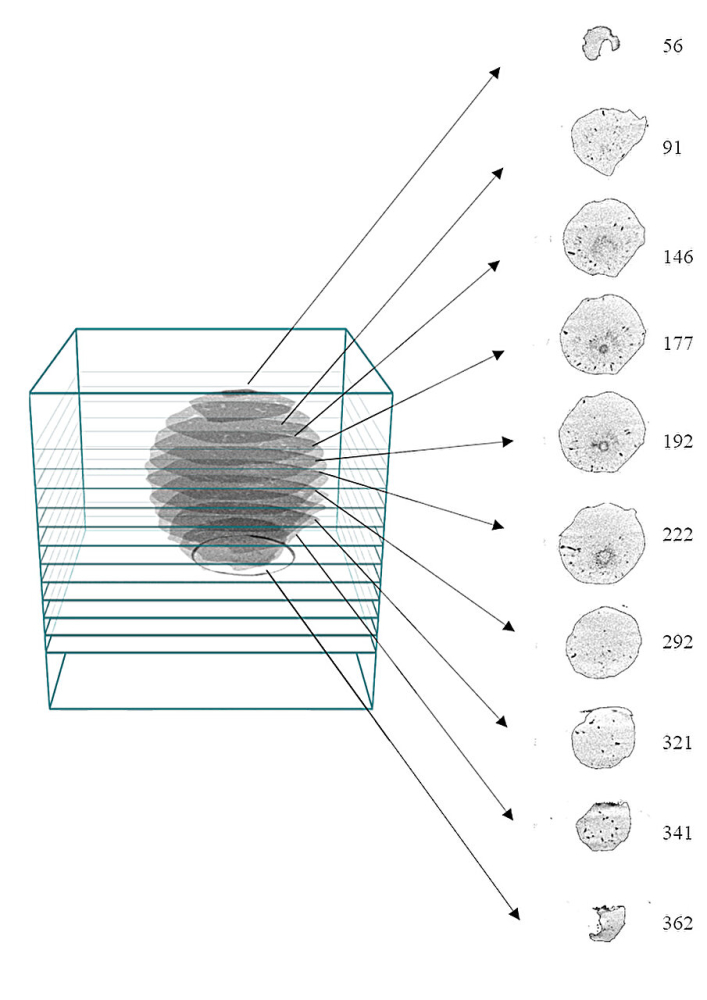 3d-scans-of-giant-hail-1