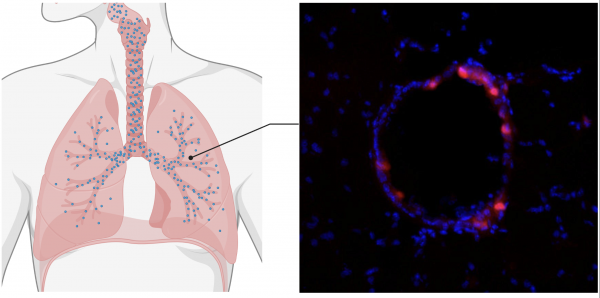 Lung-closeup_0