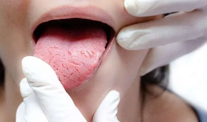 0x0-dil-renginize-dikkat-o-hastaligin-habercisi-olabilir-1726569157661