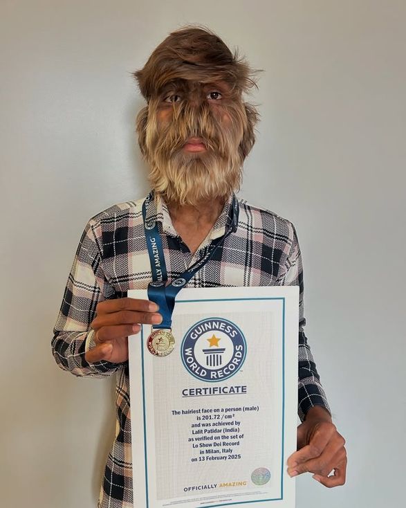 3772884_261a92be2a419f2fd9e7852123d591c3