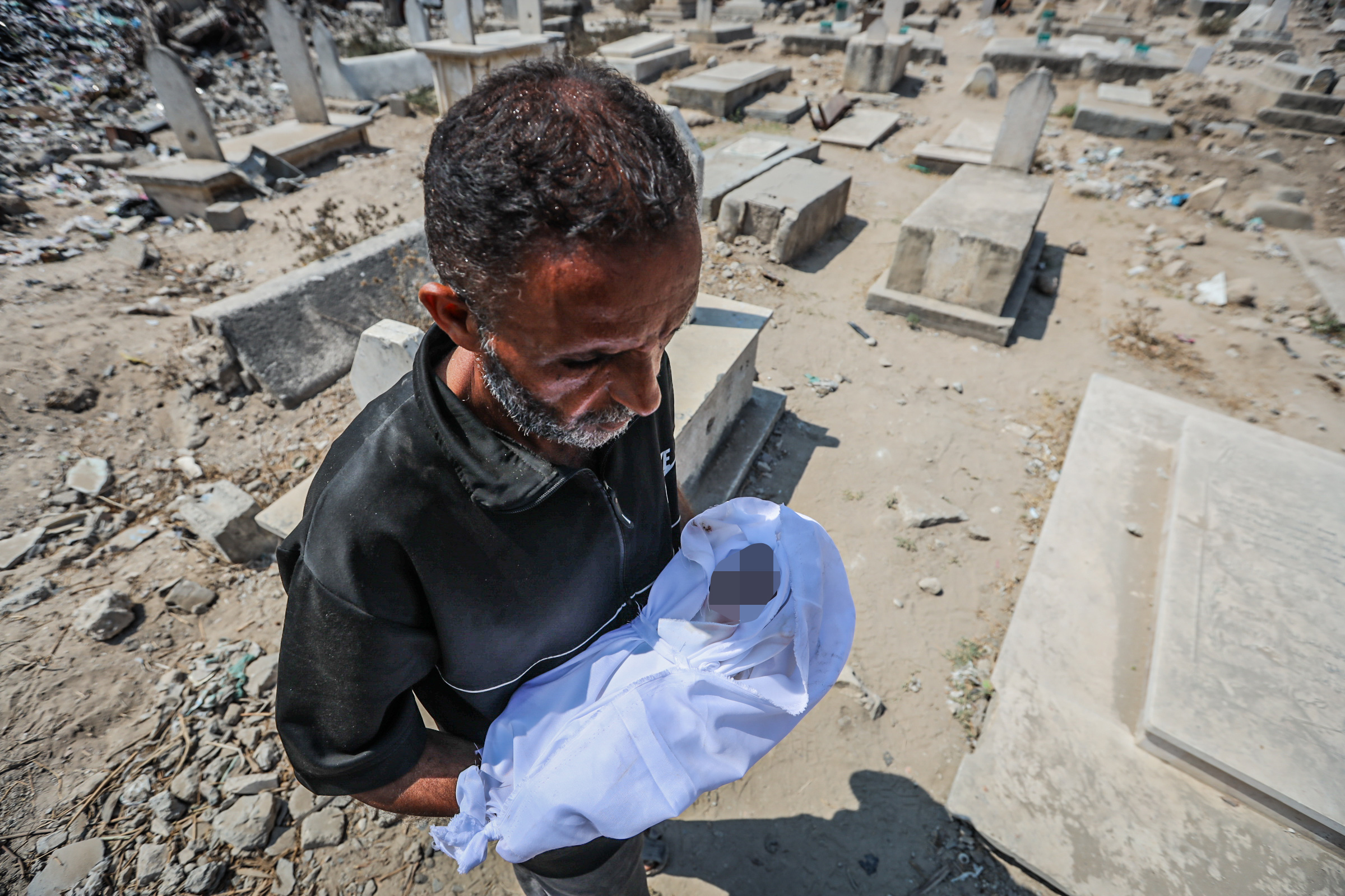 AA-20250726-38667531-38667513-GAZZEDE_ACLIK_VE_YETERSIZ_BESLENME_CAN_ALMAYA_DEVAM_EDIYOR