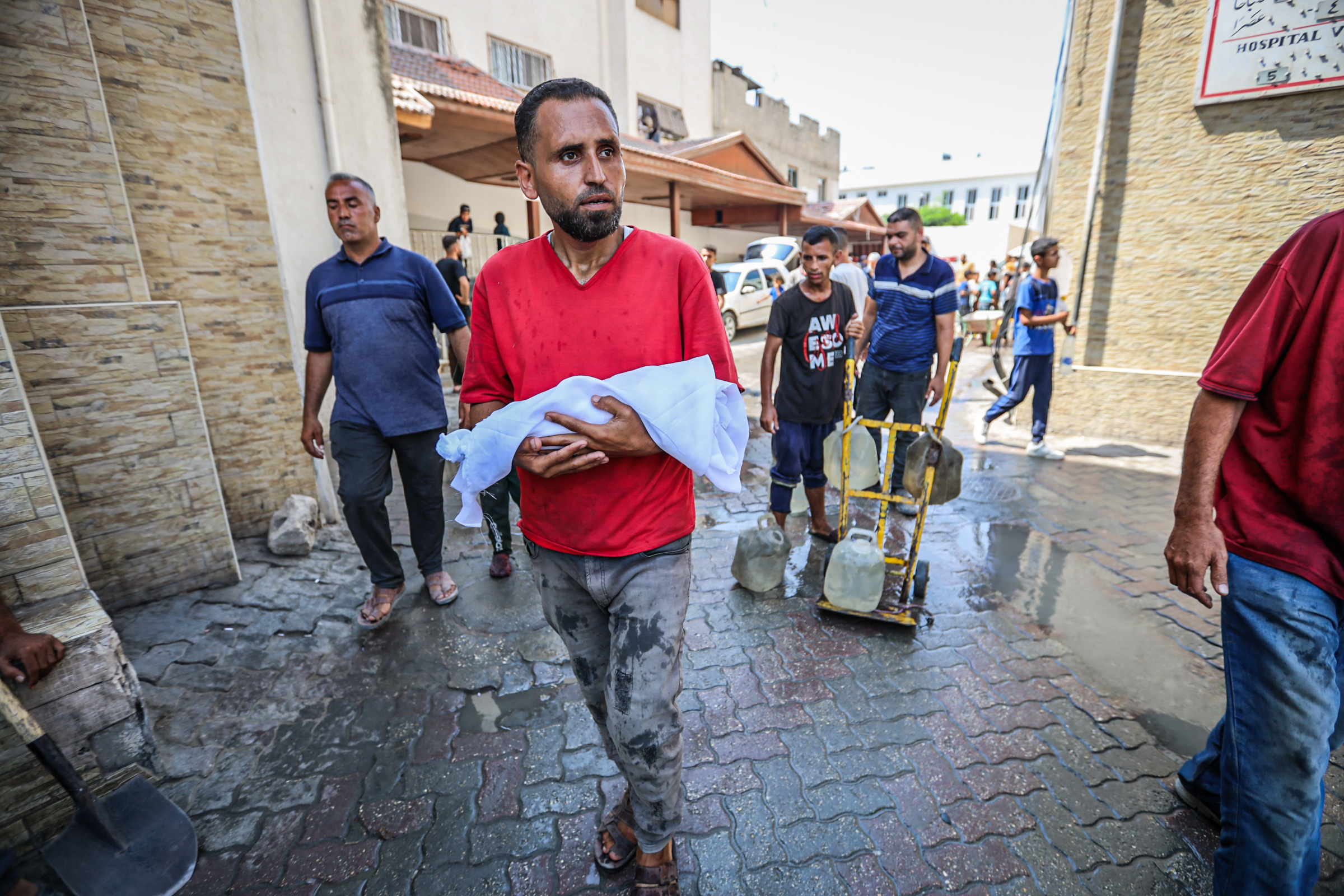 AA-20250726-38667531-38667521-GAZZEDE_ACLIK_VE_YETERSIZ_BESLENME_CAN_ALMAYA_DEVAM_EDIYOR