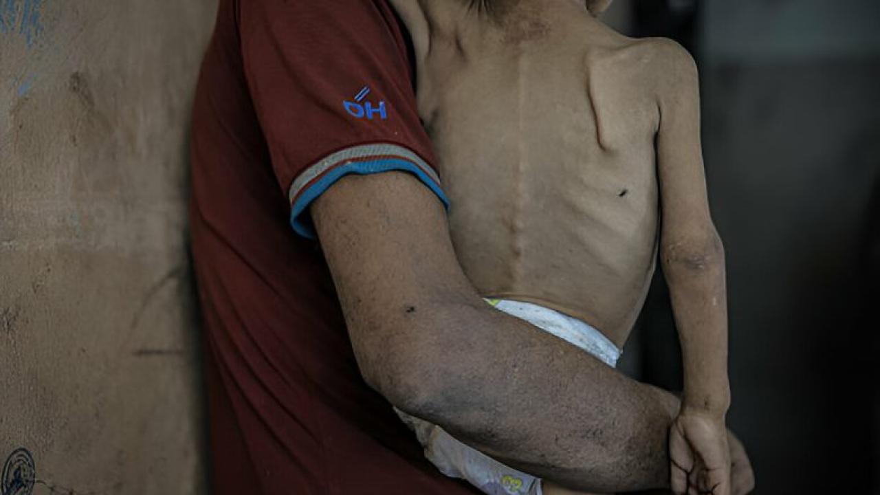 gazze-aclik-cocuk-2381463