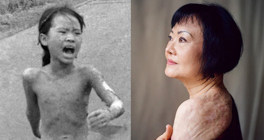 napalm-girl-then-vs-now