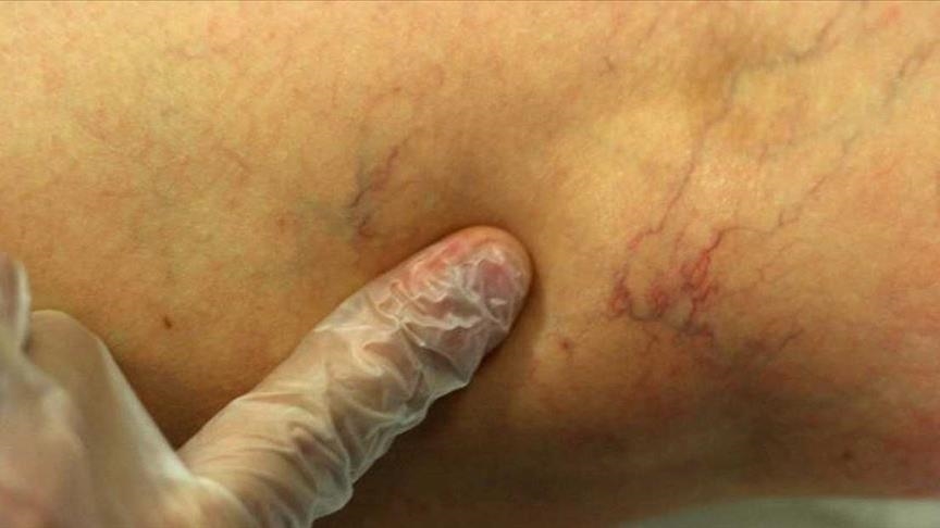 thumbs_b_c_ac625a8b472a664b4a4b3897765400d9