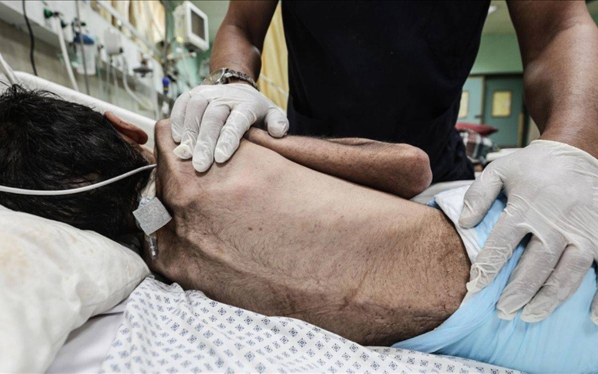 gazzede-acliktan-olenlerin-sayisi-artiyor-son-24-saatte-5-can-kaybi