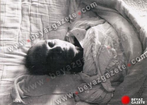 Atatürk'ün otopsi fotoğraflarının 2. bölümü