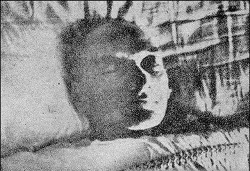 Atatürk'ün otopsi fotoğraflarının 2. bölümü