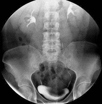 Türkiye’de en ilginç ölümler