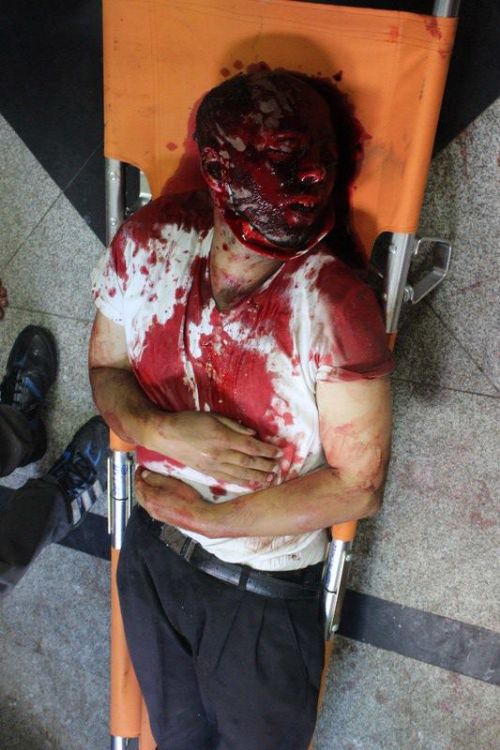 Katliamdan dehşet kareler