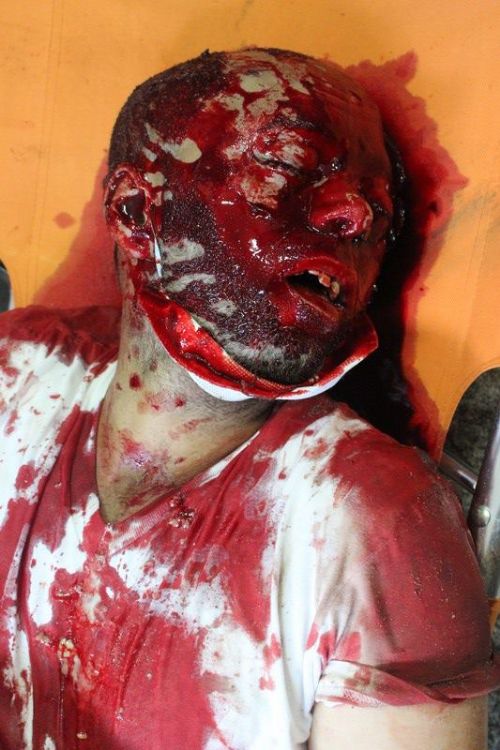 Katliamdan dehşet kareler