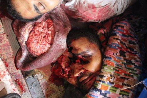 Katliamdan dehşet kareler