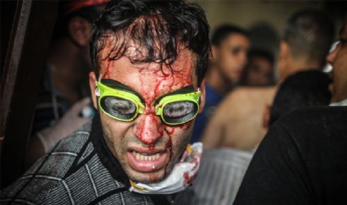 Katliamdan dehşet kareler