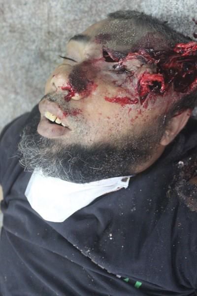 Katliamdan dehşet kareler