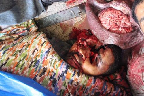 Katliamdan dehşet kareler