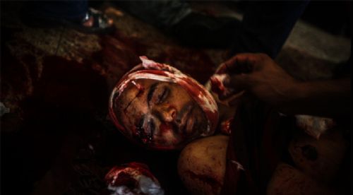 Katliamdan dehşet kareler