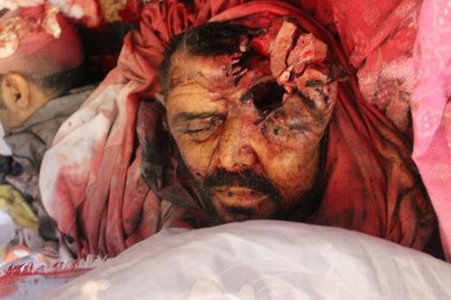 Katliamdan dehşet kareler