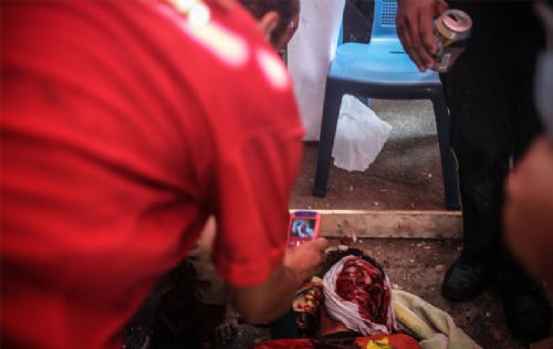 Katliamdan dehşet kareler