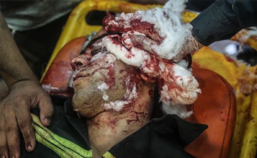 Katliamdan dehşet kareler