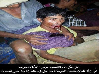 Arakan’da vahşet sürüyor! (+18)