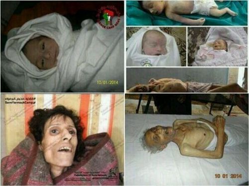 Dünyayı sarsacak Suriye fotoğrafları