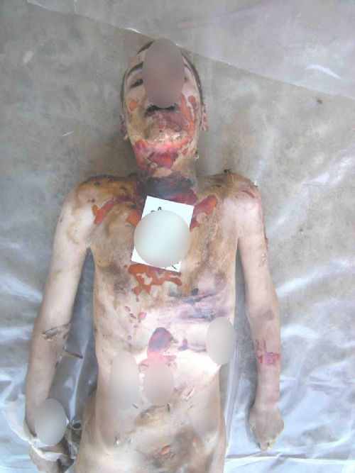 Suriye'de yeni işkence fotoğrafları (+18)