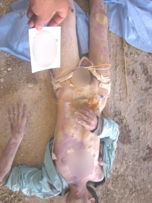 Suriye'de yeni işkence fotoğrafları (+18)