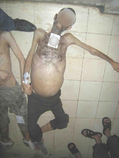 Suriye'de yeni işkence fotoğrafları (+18)