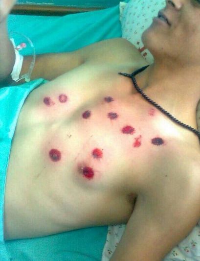 Fotoğraflarla Gazze'de neler oluyor?