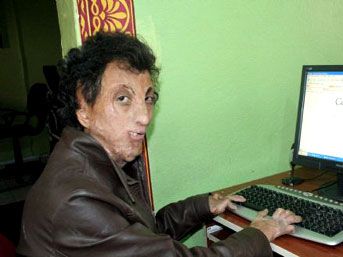 14 yıldır gözleri açık uyuyor!