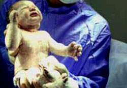 Bebek ölümleri hastane kaynaklı değil