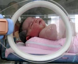 Tonton bebek öldü