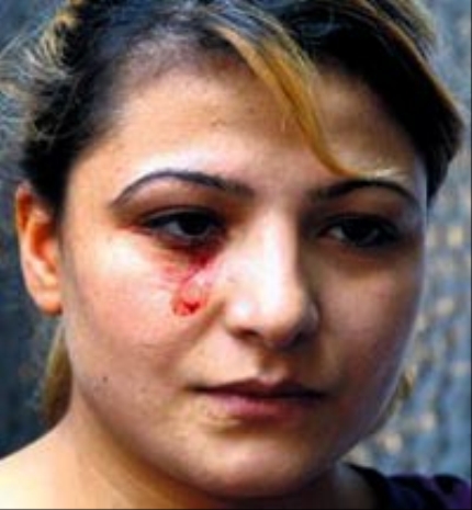 Türkiye'de stigmata vakası