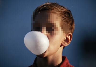 Şişirdiği sakız bomba gibi patladı ve...