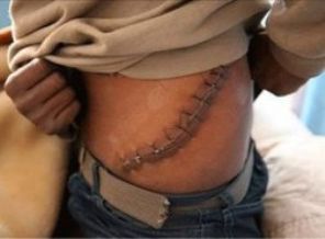 Dünya bu organ kaçakçılarını konuşuyor