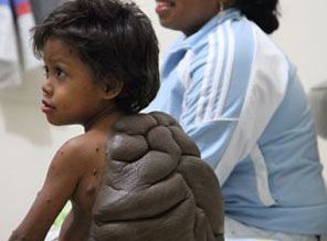 'Kaplumbağa çocuk' şoke etti