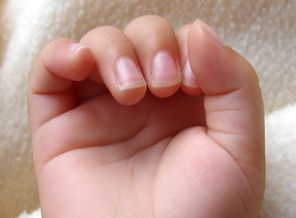 Tırnaklarımız hangi hastalıkların belirtisi