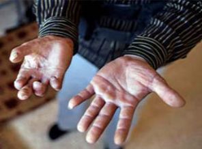 Esed'in 'kirli' savaş taktiği