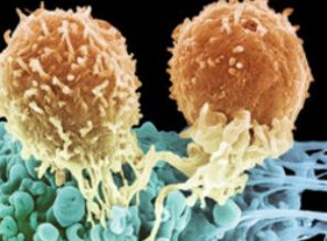 Kansere saldıran hücreler çoğaltıldı