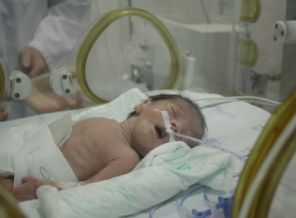 Ameliyat edilen 800 gramlık bebek hayata tutundu (Özel)