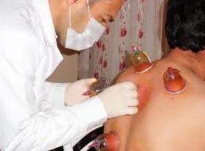 Peygamber sünneti olan hacamat nedir?