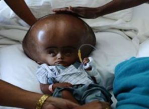 Dünyanın konuştuğu o bebekten iyi haber var!