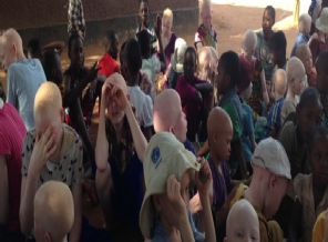 Afrika'nın 'beyaz' çocuklarına 'ilaç' niyetine tecavüz ve deri yüzme vahşeti!