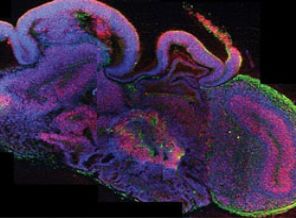 Bilincin 'açma/kapama düğmesi' bulundu