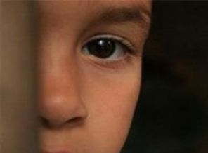 Sünnet hangi yaşlarda yapılmalı;?