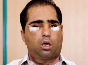 Sağlık Bakanlığı'ndan Salih Üslün açıklaması